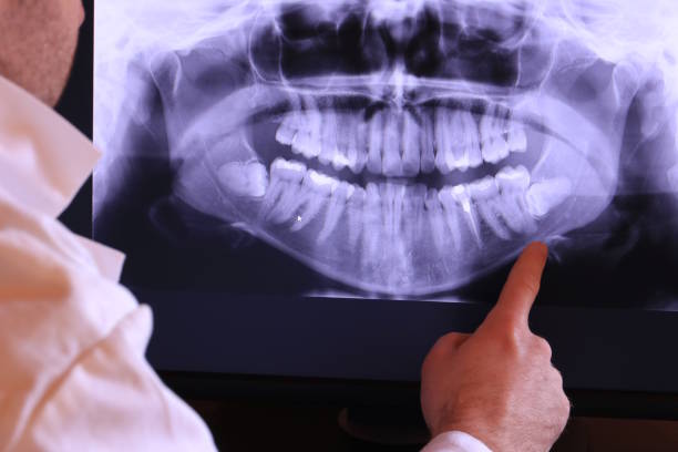 Best After-Hours Emergency Dentist in Houserville, PA