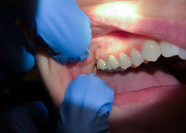 Best Emergency Orthodontic Repairs in Houserville, PA
